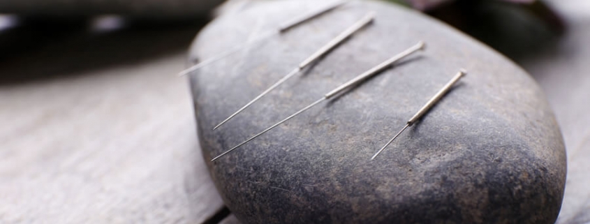 Acupuncture 101 - Questions about Acupuncture