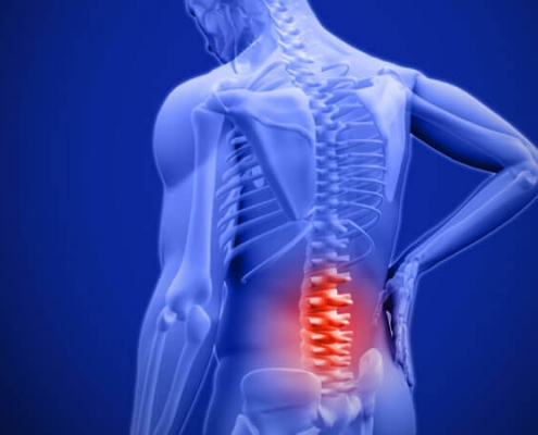 Acupuncture & Back Pain St. George