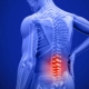 Acupuncture & Back Pain St. George