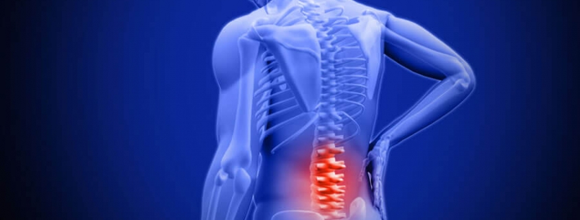 Acupuncture & Back Pain St. George