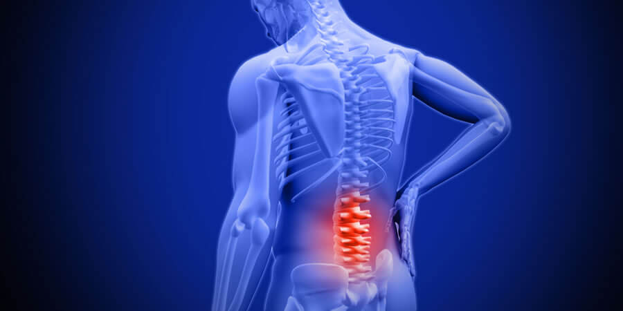 Acupuncture Back Pain Mount Dora