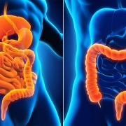 Crohn’s Disease & Ulcerative Colitis