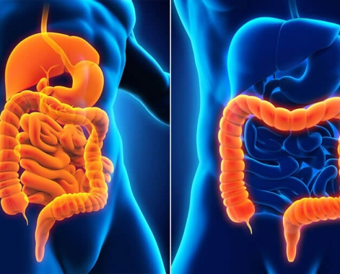 Crohn’s Disease & Ulcerative Colitis