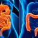 Crohn’s Disease & Ulcerative Colitis