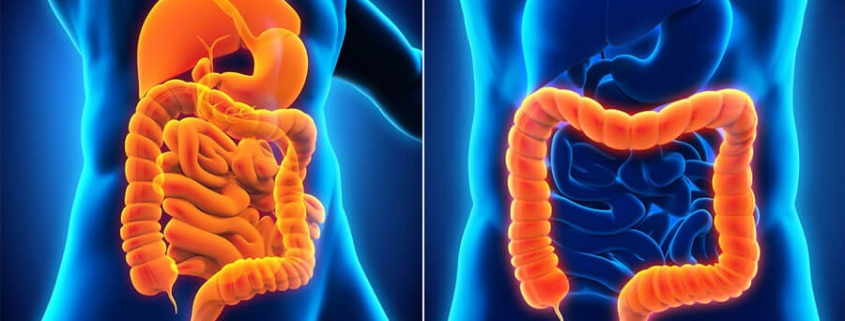 Crohn’s Disease & Ulcerative Colitis